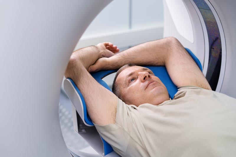 TMS Treatment May Surprise You: Effects You Should Know